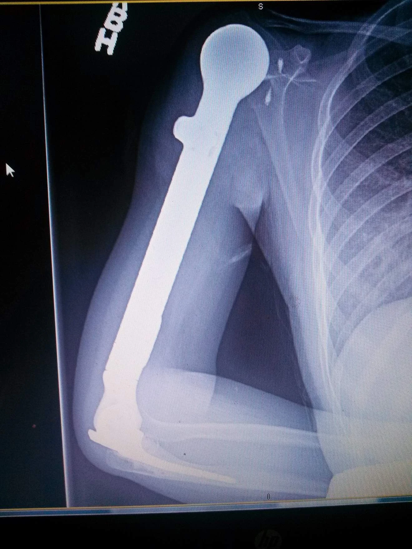 x-ray